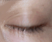oeil